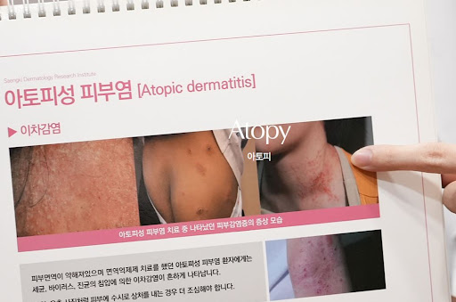 생기한의원 아토피 진료 전 증상 경과를 정리하는 방법